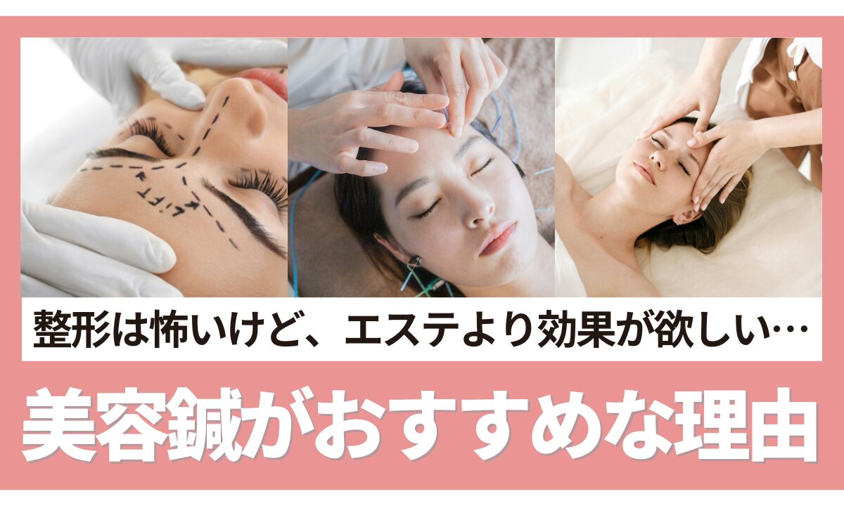 整形には抵抗がある…でもエステより踏み込みたい。そんな人に美容鍼が『ちょうどいい』理由